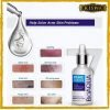 Bioaqua Pure Skin Anti Acne Serum In Pakistan