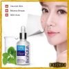 Bioaqua Pure Skin Anti Acne Serum Online Price In Pakistan
