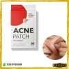 Acne Pimple Patches Reduces Excess Oil Pimple Spot Patches Kiswa.pk